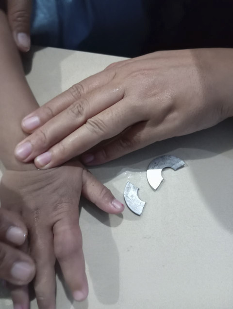 Momen petugas damkar Surabaya selamatkan jari bocah yang nyangkut di ring baut. Foto: Dok. Command Center 112 Surabaya