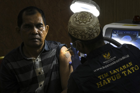 Petugas menghapus tato peserta menggunakan laser di Balai Kota DKI Jakarta, Senin (10/3/2025). Foto: Sulthony Hasanuddin/ANTARA FOTO 