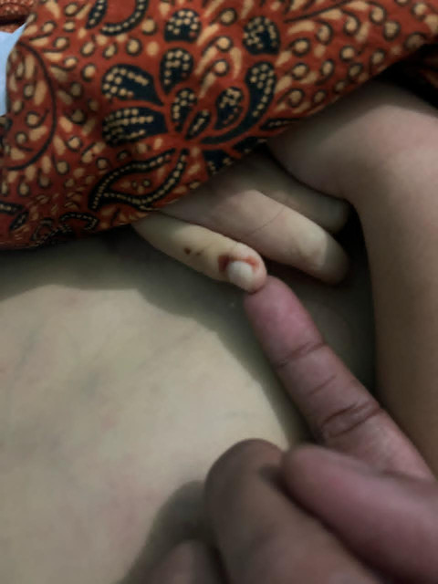 Bocah laki-laki usia 3,5 tahun di Medan ditemukan tewas tak wajar.  Foto: Dok. kumparan