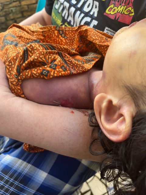 Bocah laki-laki usia 3,5 tahun di Medan ditemukan tewas tak wajar.  Foto: Dok. kumparan