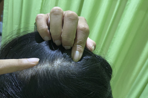 Laporan polisi terkait penganiayaan yang dialami dokter Dewi oleh dokter RI di Kabupaten Deli Serdang, Sumut. Foto: Istimewa