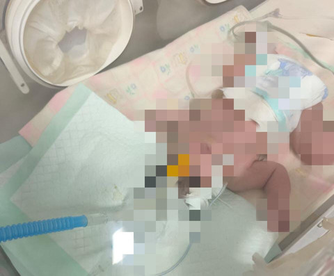 Bayi berjenis perempuan tersebut saat ini masih dirawat di RS Bhayangkara Palembang. Foto : Istimewa