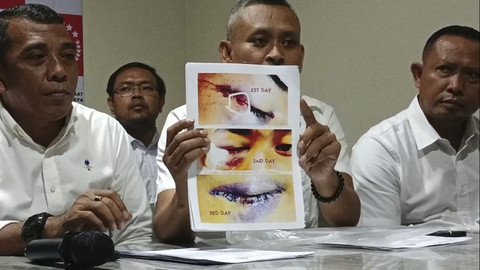 Orang tua korban bersama tim kuasa hukumnya konferensi pers anaknya, AT, siswa SMA Taruna Nala Malang yang diduga dianiaya dua seniornya. Foto: Farusma Okta Verdian/kumparan