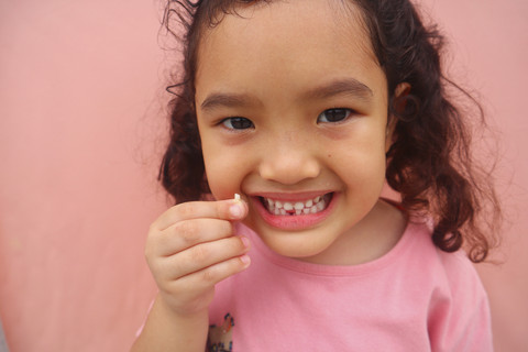 Ilustrasi Gigi Anak Copot. Foto: Shutterstock