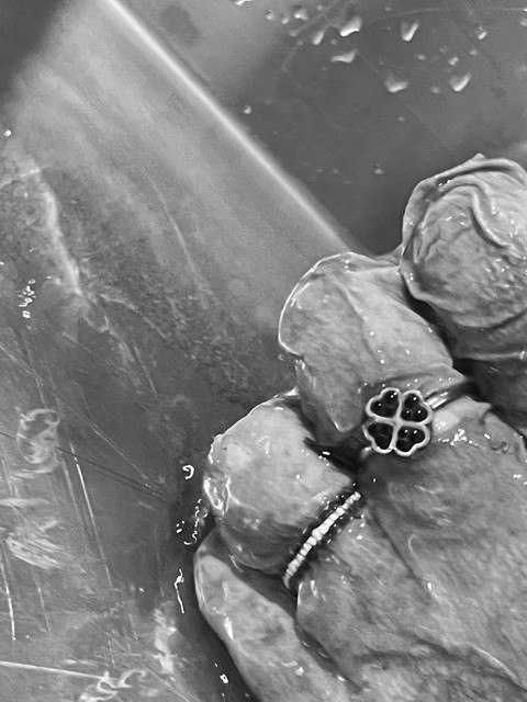 Dua cincin di jari tangan potongan tubuh yang diduga korban mutilasi di Sumatera Barat. Foto: kumparan