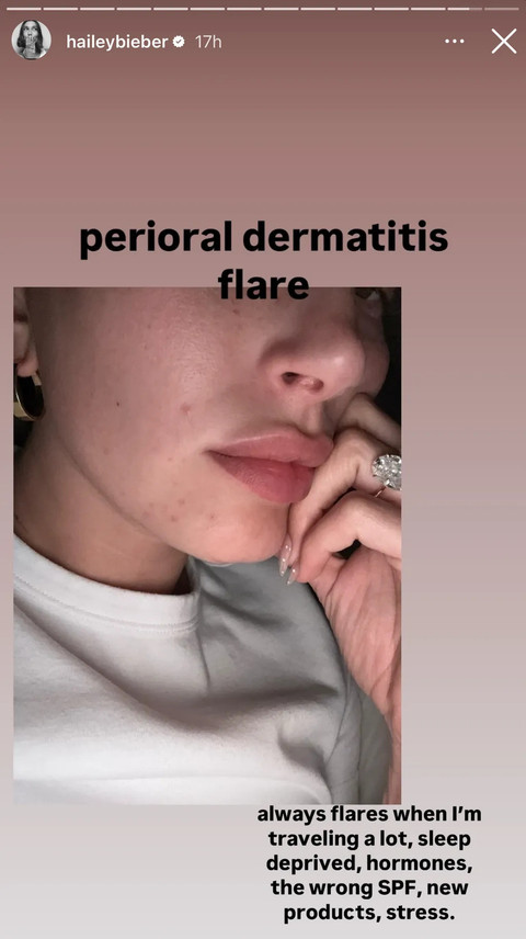  Instagram @haileybieber