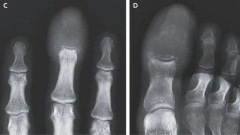 The New England Journal of Medicine