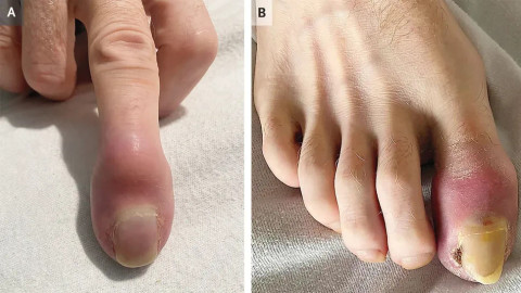  The New England Journal of Medicine