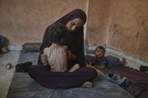 Seorang ibu menunjukkan anaknya berusia 2 tahun yang mengalami gizi buruk, berpose di rumah keluarganya di kamp pengungsi Shati, Kota Gaza, Rabu (23/7/2025). Foto: Jehad Alshrafi/AP Photo