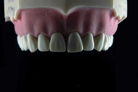 Ilustrasi Teknik Oil Pulling, Sumber Unsplash Ozkan Guner