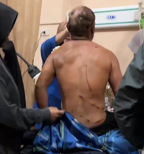 Korban yang diserang harimau. | Foto: Dok Istimewa