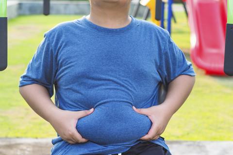 Ilustrasi anak obesitas. Foto: Shutterstock