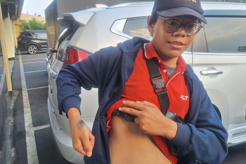 Irsyad Dulanam (22), kurir ekspedisi di Bekasi, mengalami luka akibat sabetan pedang saat mengantarkan sekaligus menagih barang dengan sistem cash on delivery (COD) kepada seorang pelanggan. Foto: Dok. kumparan