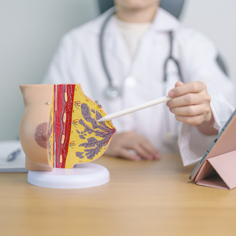 Ilustrasi Kanker Payudara. Foto: Shutterstock