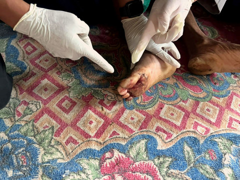 Kondisi petani yang tewas dipatuk ular king cobra di Sukabumi.  Foto: Dok. Polres Sukabumi