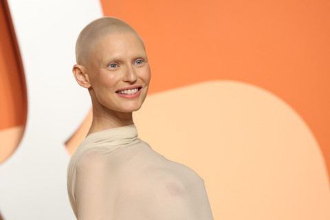 Bianca Balti. Foto: AFP/Michael Tan