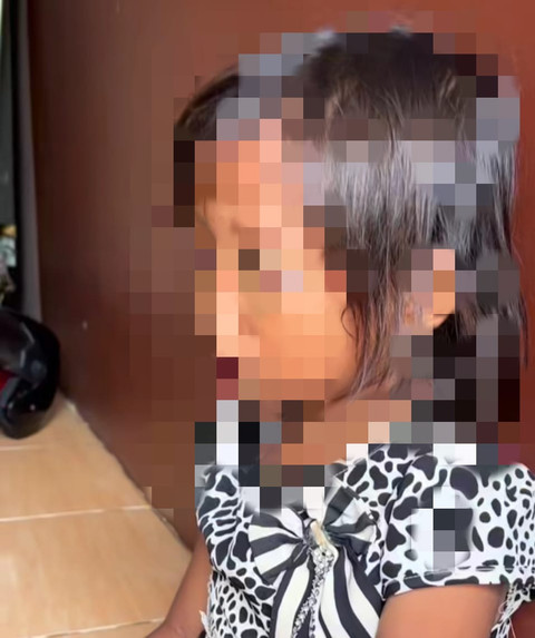 Bocah di Palembang yang mengalami kondisi mata lebam dan memerah seusai pulang dari sekolah. Foto : Istimewa