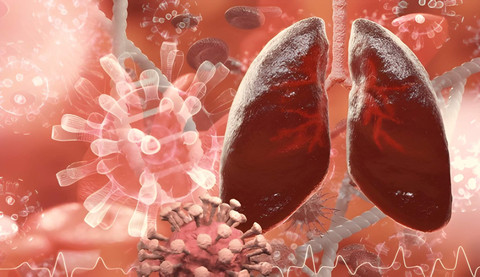 Scientific visualization of the effects of a viral infection on the respiratory system. Scientific visualization of the effects of a viral infection on the respiratory system. 3d render.Sumber : Shutterstock/Siwakorn TH