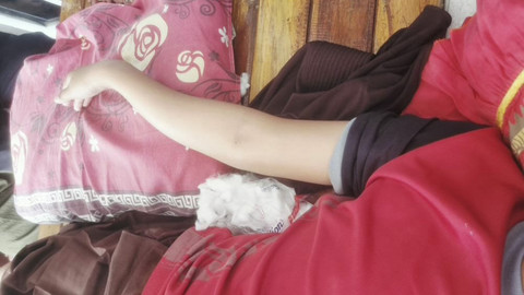 Seorang siswi kelas 6 SD negeri di salah satu Kecamatan Tirtajaya, Karawang berinisial NER, diduga menjadi korban perundungan (bullying). Foto: Dok. Istimewa