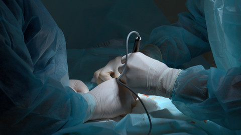 Ilustrasi sedot lemak. Foto: Media Whale Stock/Shutterstock