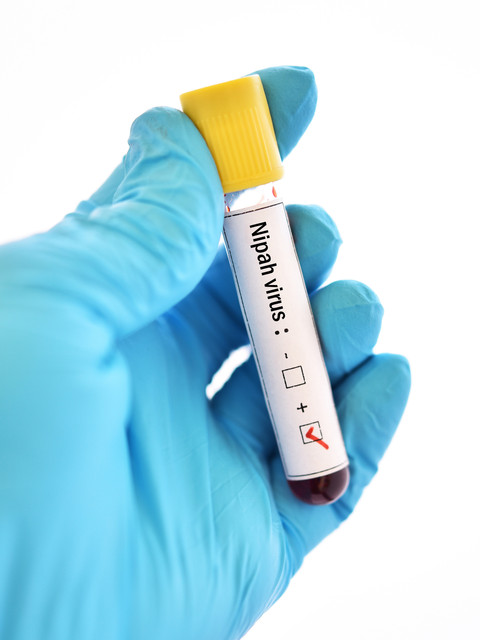 Sampel virus nipah. Foto: Jarun Ontakrai/Shutterstock