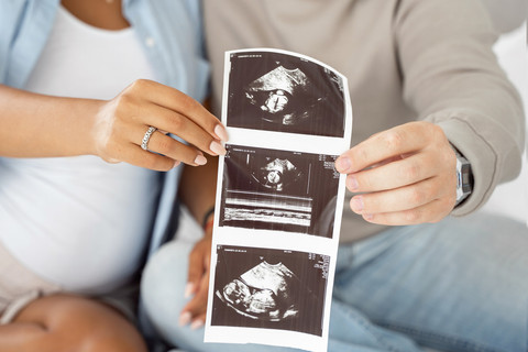 Hasil foto USG. Foto: marialevkina/Shutterstock