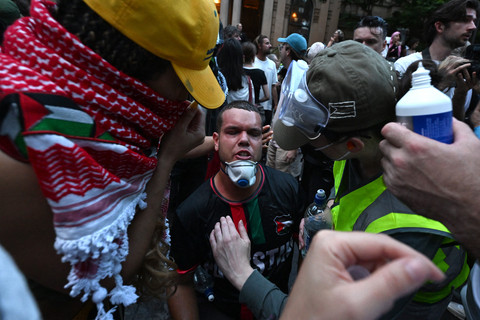 Seorang demonstran bereaksi setelah polisi menggunakan semprotan merica untuk membubarkan demonstran yang ikut serta dalam unjuk rasa pro-Palestina menentang kunjungan Presiden Israel Isaac Herzog ke Australia di Sydney, Australia, Senin (9/2/2026). Foto: Saeed Khan/AFP