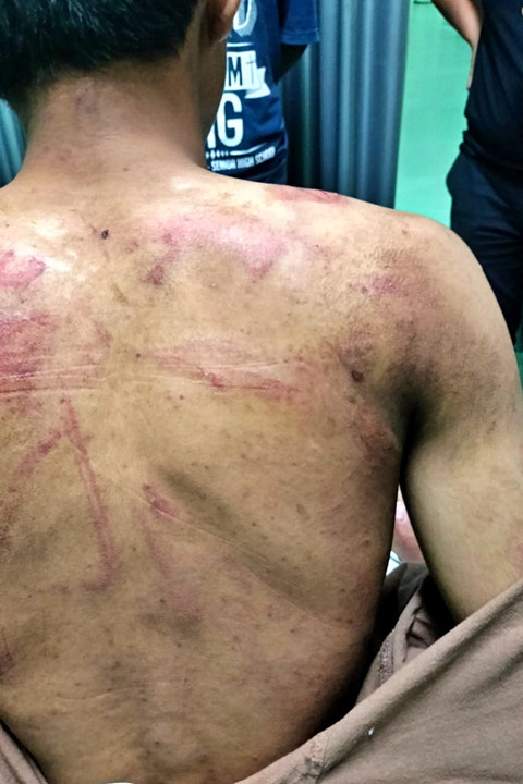 Arnendo (20), mahasiswa Universitas Diponegroro (Undip) Semarang yang diduga menjadi korban penganiayaan puluhan mahasiswa hingga babak belur. Foto: Dok. Istimewa