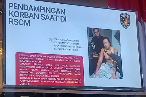 Kondisi Andrie Yunus setelah penyiraman air keras pada Kamis lalu yang ditampilkan oleh pihak kepolisian di Polda Metro Jaya, Senin (16/3). Foto: Ryan Iqbal/kumparan