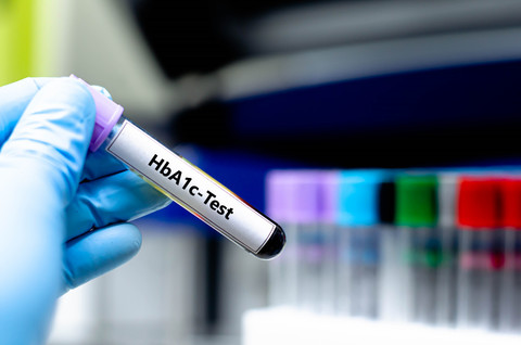 Ilustrasi diabetes. Foto: Kitsawet Saethao/Shutterstock