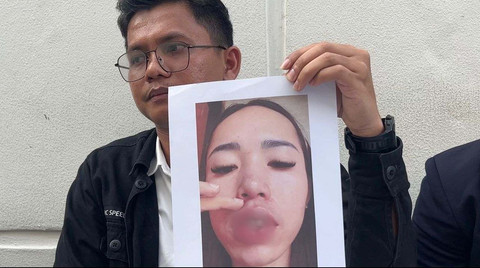 Foto salah satu korban praktik kecantikan ilegal eks finalis Putri Indonesia Jeni Rahmadial Fitri. Foto: Dok. Istimewa
