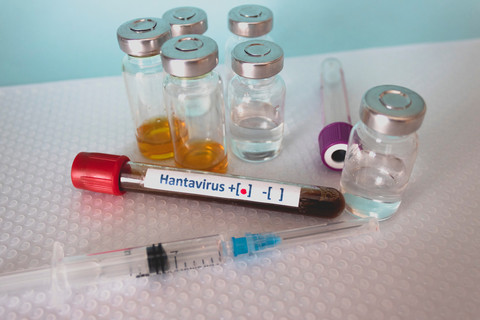 Ilustrasi hantavirus. Foto: OLESIA_V/Shutterstock