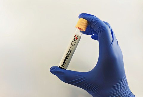 Ilustrasi hantavirus. Foto: faniadiana24/Shutterstock