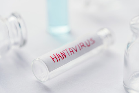 Ilustrasi Hantavirus. Foto: Nisha Dutta/Shutterstock