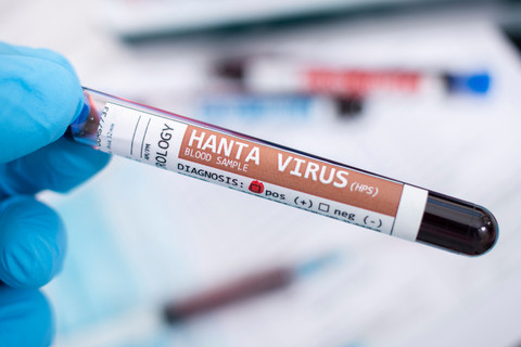 Ilustrasi Hantavirus. Foto: Mauro Rodrigues/Shutterstock