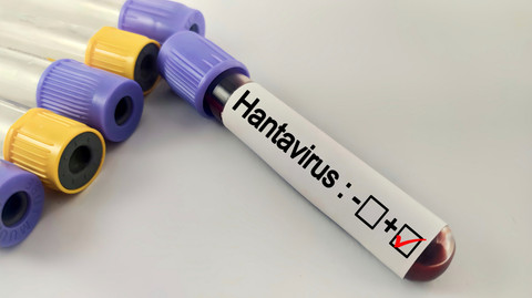 Ilustrasi Hantavirus. Foto: faniadiana24/Shutterstock