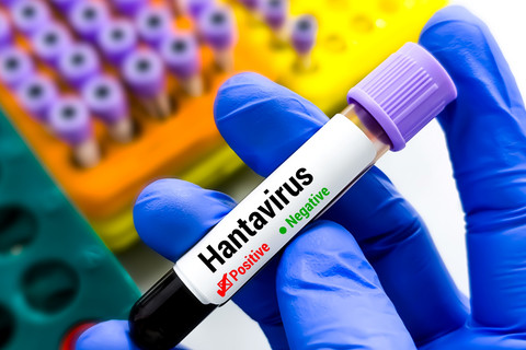 Ilustrasi Hantavirus. Foto: Saiful52/Shutterstock
