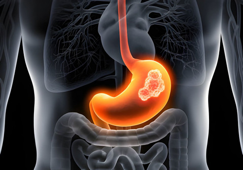 Ilustrasi Usus, Sumber:IStockphoto/peterschreiber.media