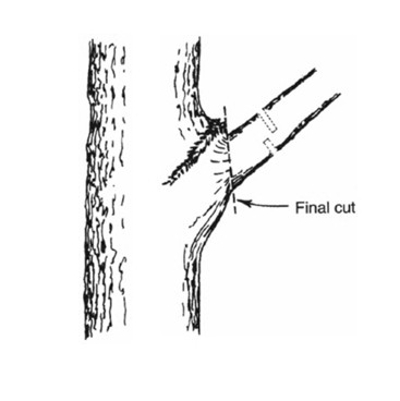 Teknik Pemangkasan Target Alami (Natural Target Pruning) yang dikenalkan oleh Alex L.Shigo