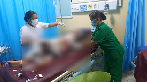 Seorang anak perempuan berinisial DEP (15) dibakar orang tuanya hingga tewas di Kampung Harapan, Distrik Sentani Timur, Kabupaten Jayapura. Foto: Dok. Istimewa