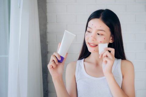 Terdapat beberapa jenis kandungan skincare yang harus dihindari untuk pemilik wajah berjerawat. Foto: Shutterstock