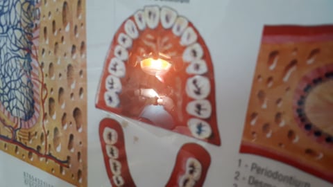 Inggris Beri Travel Warning ke Warganya yang Ingin Wisata Medis ke Turki (3)