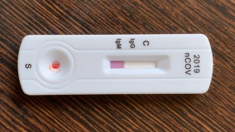 Cara Kerja Alat Rapid Test Covid 19 Buatan Orang Indonesia Harga Rp 160 000 Kumparan Com