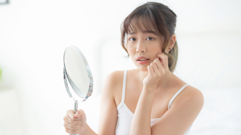 Ilustrasi masalah kulit wajah pada perempuan. Foto: Shutter Stock