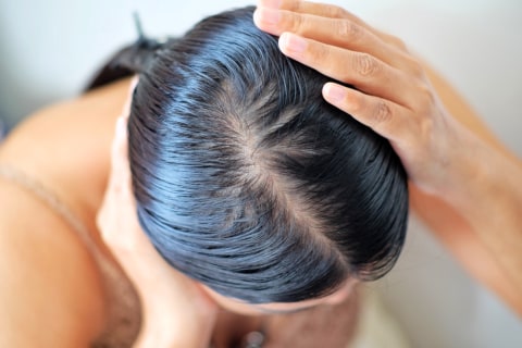 Ilustrasi Rambut Berminyak Foto: Shutter Stock