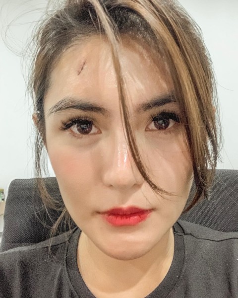Presenter Angela Lee dahinya terluka usai jatuh dari tangga. Foto: Instagram: @angelalee87.