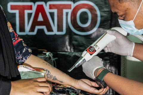 Foto: Program Hapus Tato Gratis Selama Ramadhan (1)