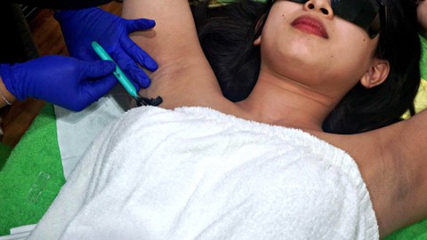 Mencukur ketiak dengan laser. Foto: Irfan Adi Saputra/kumparan