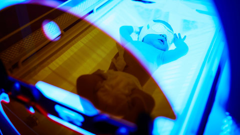 Ilustrasi bayi kuning. Foto: Shutter Stock