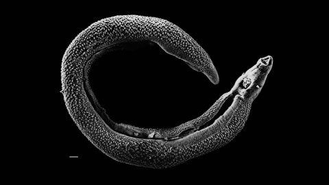 Ilustrasi cacing parasit. Foto: David Williams/Illinois State University via Wikimedia Commons